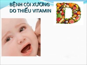 Trẻ em thiếu vitamin D mắc bệnh gì?